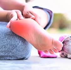 Plantar Fasciitis , Everything You Need To Know